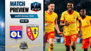 วิเคราะห์บอล เฟร้นช์ คัพ : โอลิมปิก ลียง พบกับ ล็องส์ 5/3/69