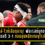 กิ๊บส์-ไวท์เลือดอาบแต่ใจเหล็ก! ฟอเรสต์บุกขย้ำเชลซี 3-1 ก่อนลุ้นหนักเกมยุโรป